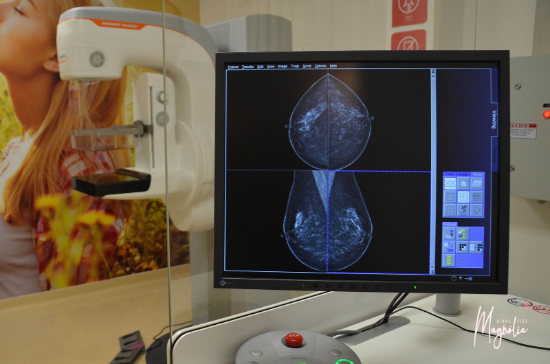 Aparelho de mamografia